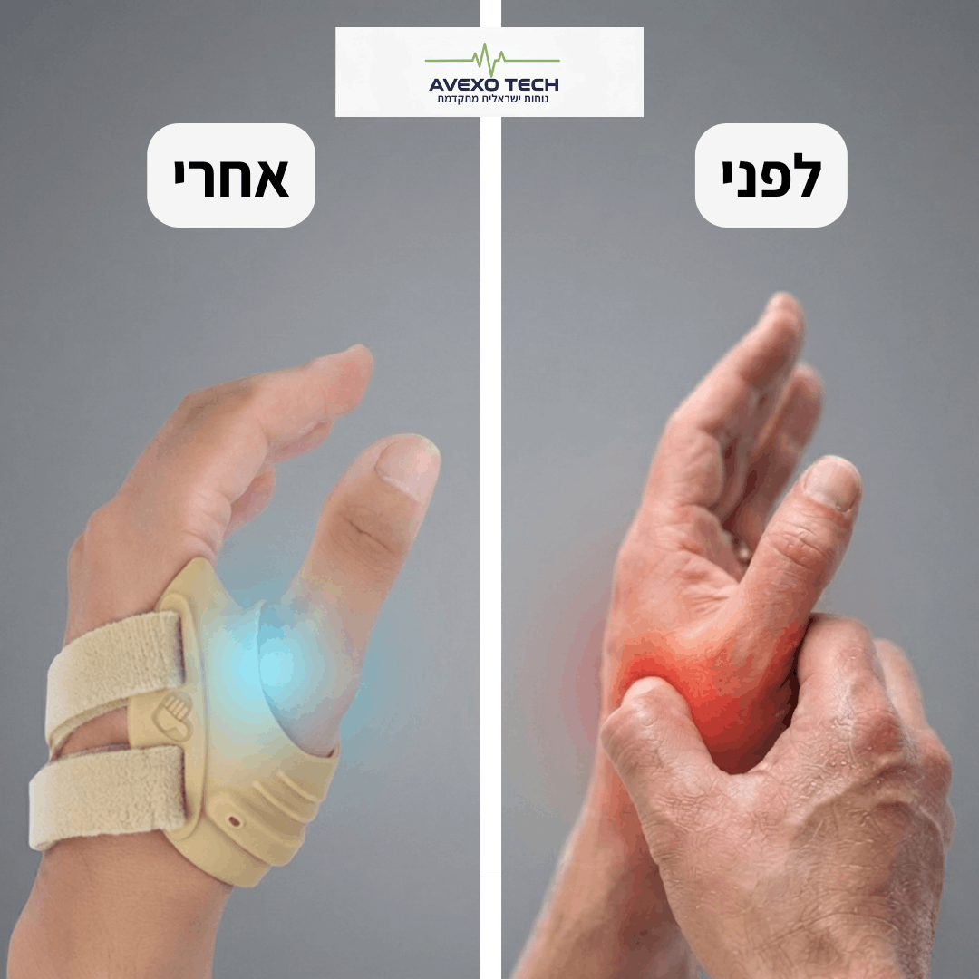 סד האגודל ™FreeTECH -  הקלה ממוקדת ללא מגבלות + תמיכת סיליקון אורתופדית במתנה!